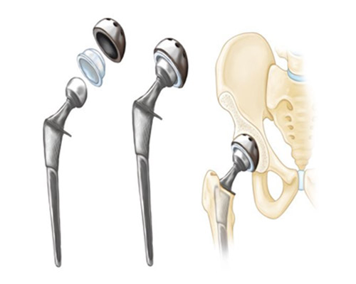 SURGICAL AND MEDICAL, Medical And Surgical Parts, Medical And Surgical Parts Manufacturer